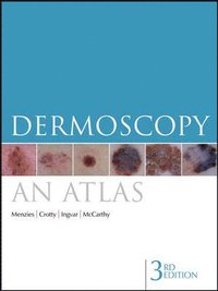 Dermoscopy; Menzies Scott, Kerry Crotty, Ingvar Christian, McCarthy William; 2009