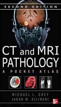CT & MRI Pathology: A Pocket Atlas; Michael Grey; 2012