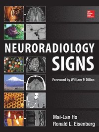Neuroradiology Signs; Mai-Lan Ho; 2014