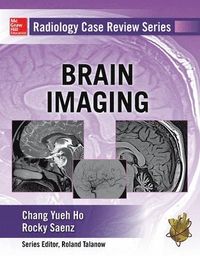 Radiology Case Review Series: Brain Imaging; Chang Ho; 2015