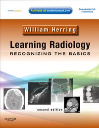 Learning Radiology; Herring William; 2011