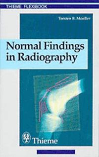 Normal Findings in Radiography; Torsten B. Moeller, Torsten B. Möller; 1999