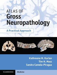 Atlas of Gross Neuropathology Book and Online Bundle; Kathreena M. Kurian, Tim H. Moss, Sandra Camelo-Piragua; 2014