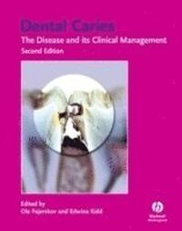 Dental Caries: The Disease and Its Clinical Management; Editor:Ole Fejerskov, Editor:Edwina Kidd; 2008