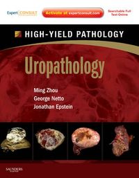 Uropathology; Ming Zhou, Netto George, Jonathan I Epstein; 2012