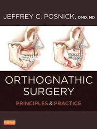 Orthognathic Surgery - 2 Volume Set; Jeffrey C. Posnick; 2013