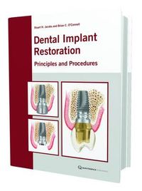 Dental Implant Restoration; Stuart H. Jacobs, Brian C. O'Connell; 2010