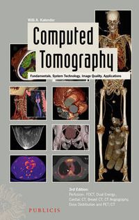 Computed Tomography: Fundamentals, System Technology, Image Quality, Applic; Willi A. Kalender; 2011