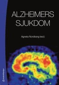 Alzheimers sjukdom; Agneta Nordberg; 2013