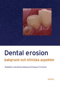 Dental erosion : bakgrund och kliniska aspekter; Ann-Katrin Johansson, Ann-Katrin Johansson; 2006