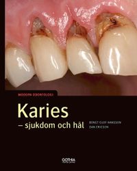 Karies : sjukdom och hål; Bengt Olof Hansson, Dan Ericson; 2019