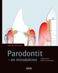 Parodontit : en introduktion; Anders Gustafsson, Björn Klinge; 2019