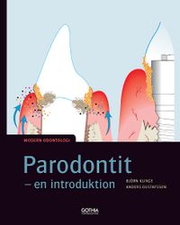 Parodontit : en introduktion; Björn Klinge, Anders Gustafsson; 2016