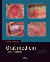 Oral medicin i teori och praktik; Ulf Mattsson, Kerstin Bäckman; 2016